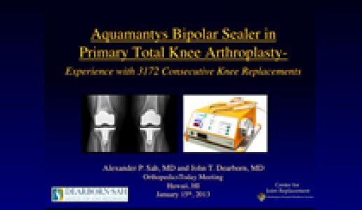 Use of the Aquamantys Bipolar Sealer in Primary TKA. An experience in 3172 consecutive procedures
