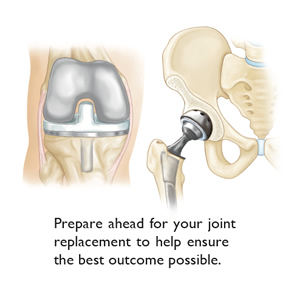 Getting ready for joint replacement