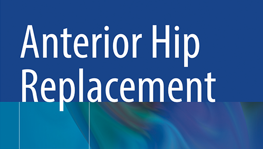 news-Anterior-Hip-Replacement.png