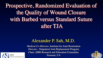 Research presentation on Optimal Wound management